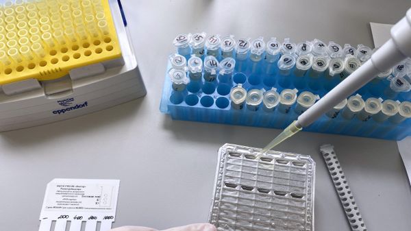 Тест-система для выявления вирусов в организме человека