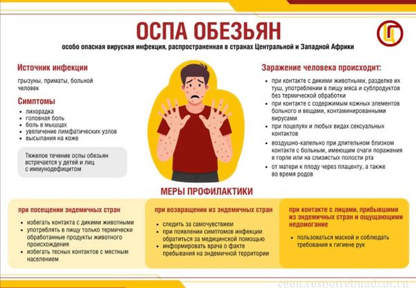 Оспа обезьян – инфографика