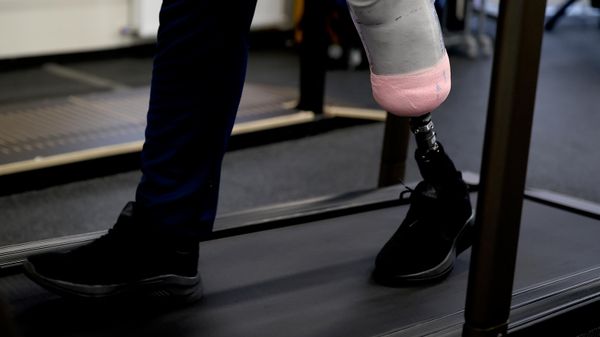 Центр протезирования и реабилитации